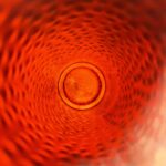 Varinė gertuvė su defektu, 1000 ml - Image 2